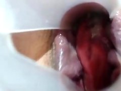 both holes fuck fist and spread on Vacation, pee,speculum and put pee in pussy and ass,show in